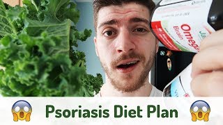 Psoriasis Diet Plan You WONT Survive  Vlog 2 [upl. by Ferretti761]