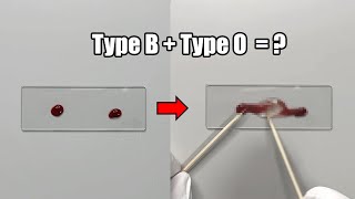 What Happens When Two Different Blood Types are Mixed Together [upl. by Anamuj]