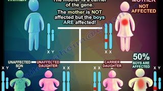 X Linked Recessive Inheritance  Everything You Need To Know  Dr Nabil Ebraheim [upl. by Rosane]