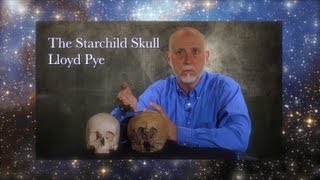 Starchild Skull DNA is Alien  Lloyd Pye [upl. by Norby592]