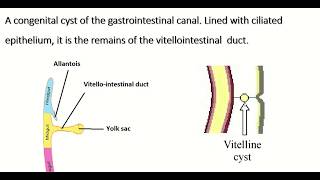 Embryology of vitellointestinal duct  formation fate amp congenital anomalies [upl. by Aerdnaz]