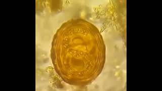 🔬Huevos embrionado de Ascaris lumbricoides bajo el microscopio  Parasitología [upl. by Tennos]