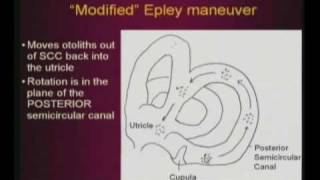 Epley Maneuver [upl. by Blaine24]