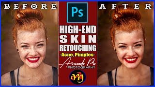 HighEnd Skin Retouching PhotoshopRemove Acne skin pores easily [upl. by Haeli600]