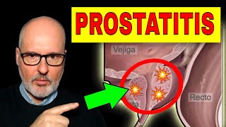 PROSTATITIS AGUDA y CRÓNICA Síntomas Causas y Tratamiento [upl. by Nevad]