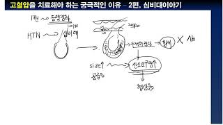 고혈압을 치료해야 하는 궁극적 이유 2편  심비대이야기 [upl. by Giuliana607]