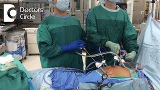 Dos amp Donts after Gynaecologic Laparoscopic Surgeries  Dr Shafalika Boriah [upl. by Lothar512]