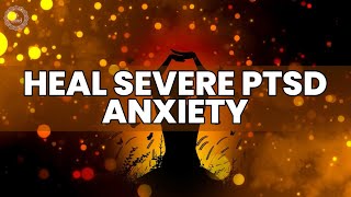 Heal Severe PTSD Anxiety IBS and Depression  Overcome Pain and Sleep Problems  Binaural Beats [upl. by Hpesojnhoj]