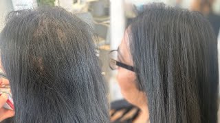 V lights hair extensions for thinning hair thinninghairsolution hairlosstreatment [upl. by Bessie]