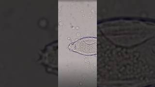 schistosoma haematobium in urine slide test viral shorts [upl. by Alfons]