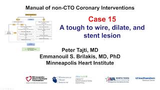 Case 15 PCI Manual  Balloon undilatable [upl. by Sorilda]