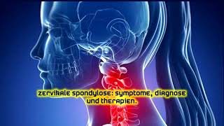 Zervikale Spondylose Symptome Diagnose und Therapien [upl. by Bowie]