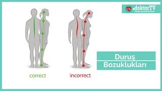 Duruş Bozuklukları  Dik Duruş  Postür Düzeltme  Kamburluk  DoçDrSaliha DEMİR EROĞLU [upl. by Krissie]