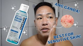 OXECURE ULTRA GENTLE FACIAL CLEANSER REVIEW FOR ONE MONTH  BEST FOR SENSITIVE SKIN AND BREAKOUTS [upl. by Kinemod415]