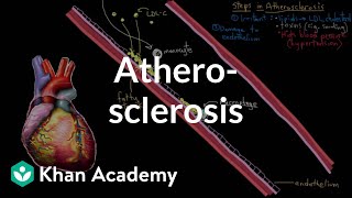 Atherosclerosis  Circulatory System and Disease  NCLEXRN  Khan Academy [upl. by Hamas727]