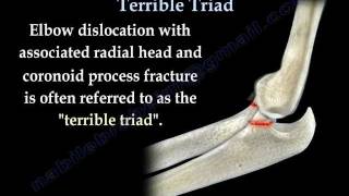 Elbow Fracture Dislocation Terrible Triad  Everything You Need To Know  Dr Nabil Ebraheim [upl. by Yemar]