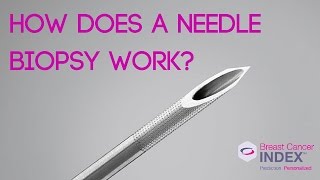 How Does a Needle Biopsy Work [upl. by Nari]