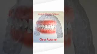 MacamMacam Retainer shortvideo asmr fypシ viral health [upl. by Beaulieu]