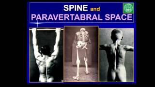 Pain Medicine  Sonoanatomy  Peripheral Nerves Spine and Paravertebral Space [upl. by Aldora956]