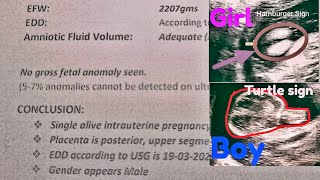 How to know baby boy or girl in ultrasound report  Urdu  Hindi [upl. by Zednanreh]