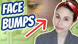 How to get rid of bumps on the face Dr Dray [upl. by Packston]