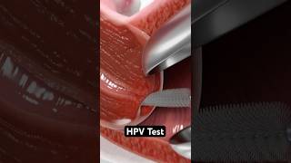 HPV Test 3D Animation [upl. by Eurydice690]