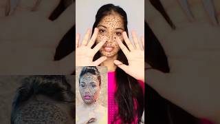 Henna freckles😰 challenge😭 mehndishorts hack youtubeshorts makeuphackviralhacks [upl. by Ardnaz548]