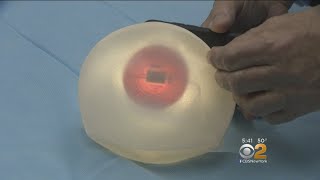 New Procedure Making Breast Reconstruction Surgery More Convenient [upl. by Lanford]