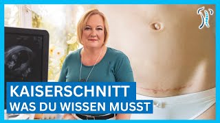 Gynäkologin erklärt Kaiserschnitt  Ablauf Narbe amp Heilung – Was du wissen musst [upl. by Vas716]