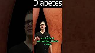 Diabetic Dermopathy Pictures amp Treatment Diabetes Symptoms amp Signs [upl. by Hattie406]