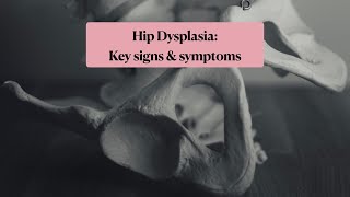 Hip dysplasia key signs and symptoms [upl. by Enoyrt]