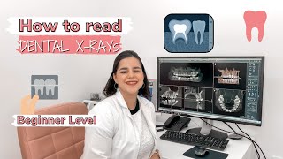 HOW TO READ DENTAL XRAYs  Beginner Level  Bianca Oprea [upl. by Eive543]