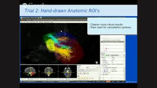 Emerging Cerebellar Tractography  Dr Re  FNNDSC Talk [upl. by Iadam]