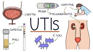 Understanding Urinary Tract Infections [upl. by Ahseym]