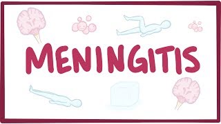 Meningitis  causes symptoms diagnosis treatment pathology [upl. by Arianne]