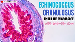 Echinococcus granulosus under the microscope with WadeFite stain [upl. by Arluene810]