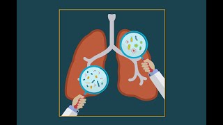 Pneumocystis jiroveci pneumonia pcp [upl. by Warp608]