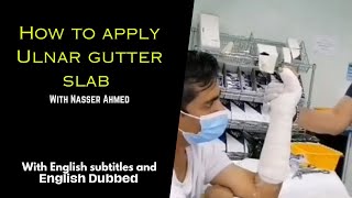 How to apply Ulnar gutter slabtreatment of boxer fracture and little finger fracture Eng dubbed [upl. by Hortensia]