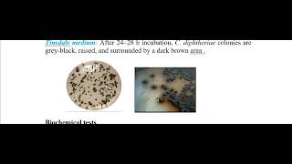 Gram positive Rods [upl. by Harden]