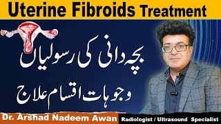 Uterine Fibroids CausesTypesSymptoms And Treatment [upl. by Adikram]