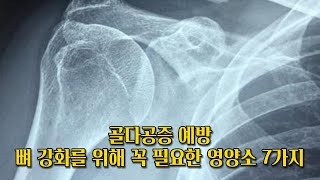 골다공증 예방뼈 강화를 위해 꼭 필요한 영양소 7가지 [upl. by Askwith]