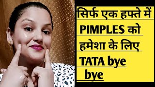 Pimples को बोलो TaTa bye bye simple step to remove acne amp get clear amp spotless skin acnetreatment [upl. by Onateag]