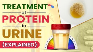 Treatment Of Protein In Urine Explained [upl. by Ardolino]