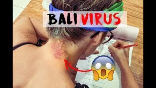 CATCHING NASTY SKIN VIRUS IN BALI FOR HER BIRTHDAY [upl. by Dine108]