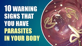 Dont Ignore These Early Symptoms of Parasites In Your Body [upl. by Hsevahb]