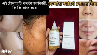 The Ordinary Glycolic acid 7 Exfoliating Toner কি কি কাজ করে থাকে এটা আমাদের স্কিন এর জন্য কতটা উ [upl. by Ehr]