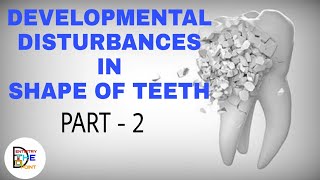 DEVELOPMENTAL DISTURBANCES IN SHAPE OF TEETH PART 2 [upl. by Acinomaj]