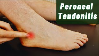 Peroneal Tendonitis Explained by Foot Specialists [upl. by Einwat863]