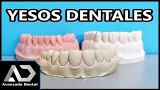 Tipos De Yeso Dentales Odontología miniClase [upl. by Anoel125]