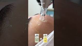 How to mix and use two booster ampoules BB Glow Facil BB Glow Treatment bbglow koreanskincare [upl. by Ellirpa]